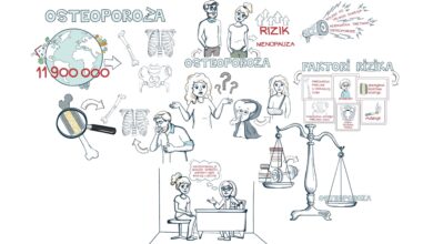 Osteoporoza video