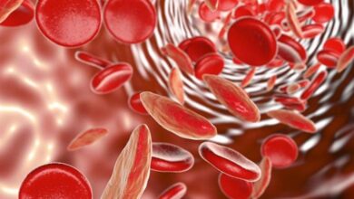 Perniciozna anemija (Anaemia perniciosa) - najčešća pitanja