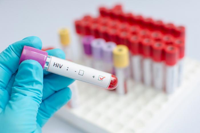 HIV i SIDA: Koja je razlika? 1 HIV i SIDA: Koja je razlika?