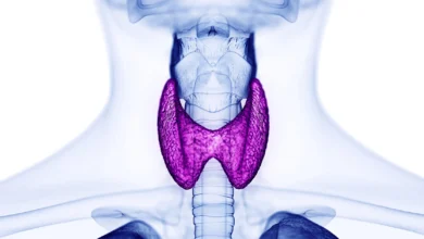 Hipertireoza-Hyperthyrosis 1 Hipertireoza-Hyperthyrosis