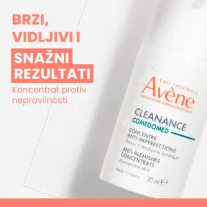 Nega masne kože 3 Nega masne kože