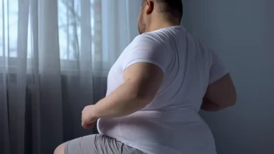 Gojaznost: Više od estetskog problema