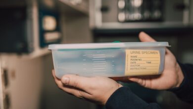 Escherichia coli u urinu — šta nalaz znači i kada se leči 2 Ruke drže posudicu sa uzorkom urina u laboratoriji