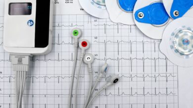 EKG aparat sa elektrodama i ispisom srčanog ritma